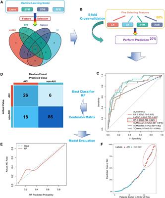 Machine learning for the prediction of acute kidney injury in patients after cardiac surgery